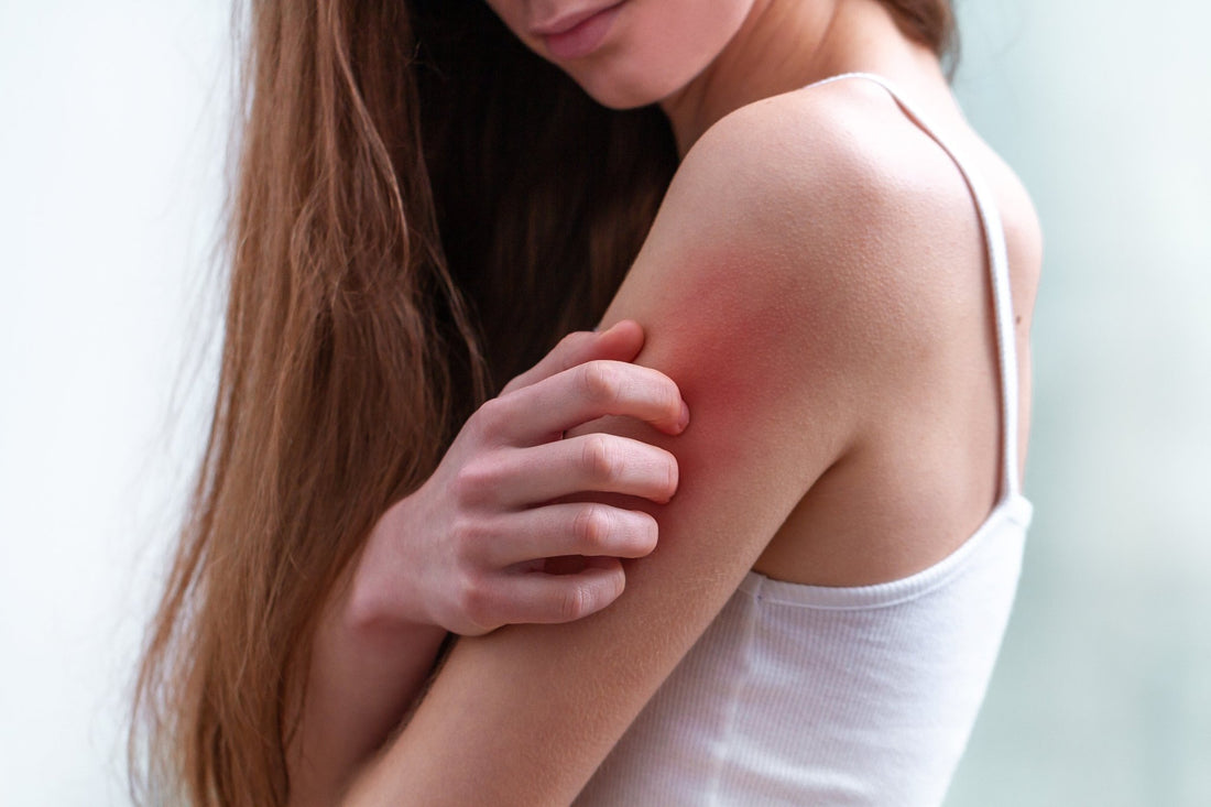 Understanding Eczema: Everything You Need to Know About This Common Skin Condition - Kidskin