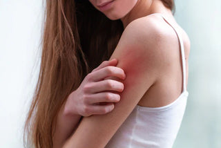 Understanding Eczema: Everything You Need to Know About This Common Skin Condition